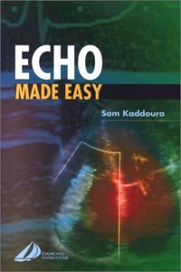 Echo Made Easy