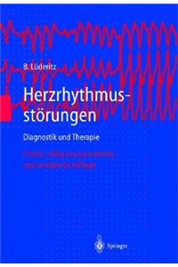 Herzrhythmusstarungen: Diagnostik Und Therapie