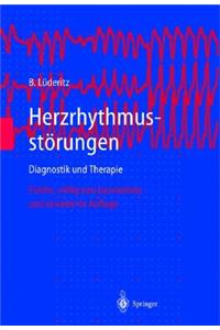 Herzrhythmusstarungen: Diagnostik Und Therapie