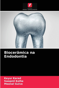 Biocerâmica na Endodontia