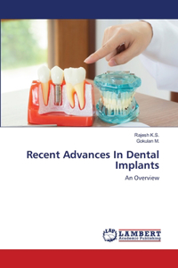 Recent Advances In Dental Implants
