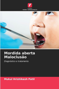 Mordida aberta Maloclusão