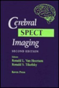 Cerebral Spect Imaging