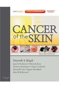 Cancer of the Skin