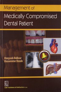 Management Of Medically Compromised Dental Patient