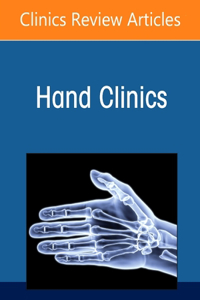 Current Concepts in Thumb Carpometacarpal Joint Disorders, an Issue of Hand Clinics, E-Book