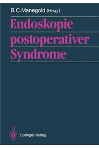 Endoskopie Postoperativer Syndrome