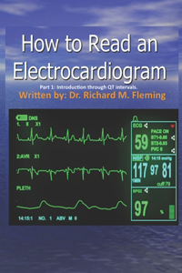 How to Read an Electrocardiogram.