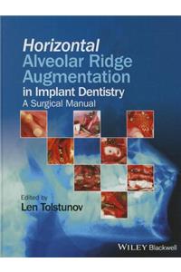 Horizontal Alveolar Ridge Augmentation in Implant Dentistry
