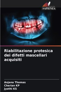 Riabilitazione protesica dei difetti mascellari acquisiti