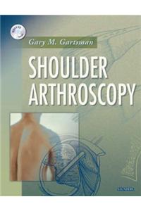 Shoulder Arthroscopy