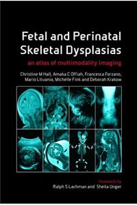 Fetal and Perinatal Skeletal Dysplasias