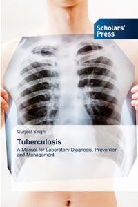 Tuberculosis