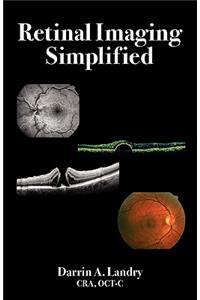 Retinal Imaging Simplified