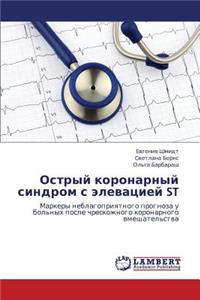 Ostryy Koronarnyy Sindrom S Elevatsiey St