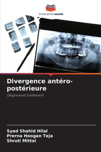 Divergence antéro-postérieure