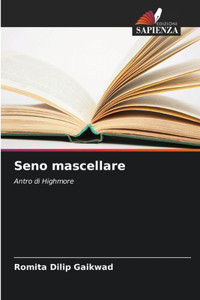 Seno mascellare