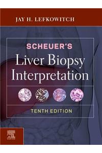 Scheuer's Liver Biopsy Interpretation E-Book