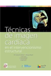 Tecnicas de Imagen Cardiaca