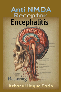 Mastering Anti NMDA Receptor Encephalitis