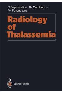 Radiology of Thalassemia