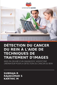 Détection Du Cancer Du Rein À l'Aide de Techniques de Traitement d'Images