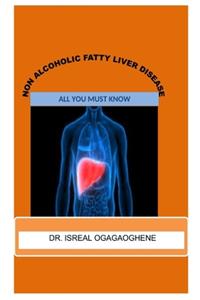 Non alcoholic fatty liver disease