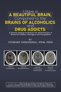 I Have a Beautiful Brain, Compared to the Brains of Alcoholics and Drug Addicts