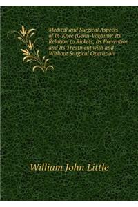 Medical and Surgical Aspects of In-Knee (Genu-Valgum)