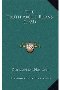 Truth About Burns (1921)