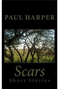 Scars