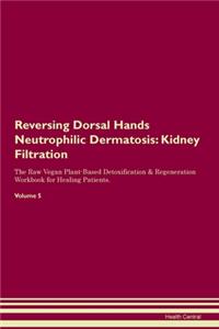 Reversing Dorsal Hands Neutrophilic Dermatosis