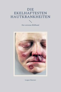 ekelhaftesten Hautkrankheiten: Der extreme Bildband