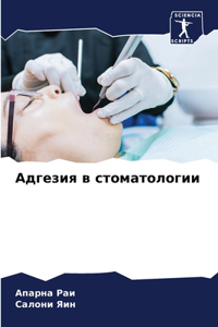 Адгезия в стоматологии