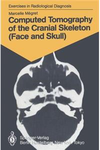 Computed Tomography of the Cranial Skeleton (Face and Skull)