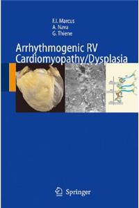 Arrhythmogenic RV Cardiomyopathy/Dysplasia