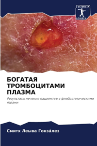 БОГАТАЯ ТРОМБОЦИТАМИ ПЛАЗМА