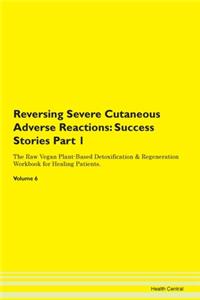 Reversing Severe Cutaneous Adverse React