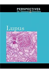 Lupus