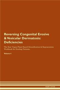 Reversing Congenital Erosive & Vesicular Dermatosis