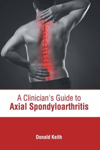 Clinician's Guide to Axial Spondyloarthritis