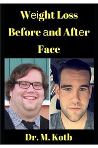 Weight Loss Before and After Face