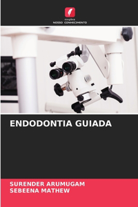 Endodontia Guiada