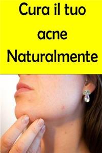 Cura il tuo acne Naturalmente