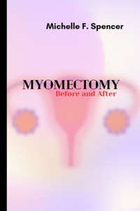 Myomectomy, before and after