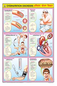 Teachingnest | Overnutrition Disorders Chart (70X100Cm) | Food And Nutrition Chart | Wall Sticking | English - Hindi Combined