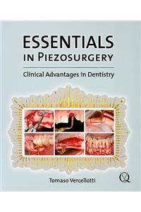 Essentials in Piezosurgery