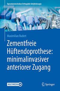 Zementfreie Hüftendoprothese: Minimalinvasiver Anteriorer Zugang