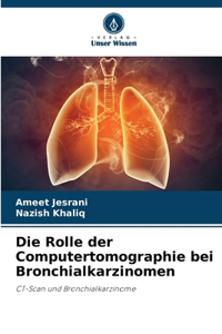 Rolle der Computertomographie bei Bronchialkarzinomen