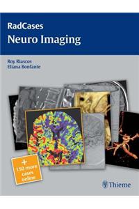 Neuro Imaging